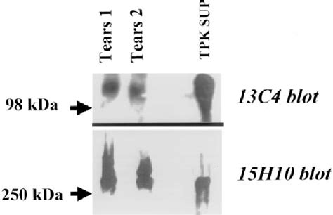 Figure From Detection Of Sialomucin Complex Muc In Human Ocular