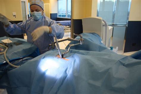 METRx Micro Endoscopic Spine Surgery