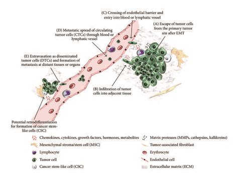 Schematic View Of Metastatic Process Metastatic Cascade Starting From Download Scientific