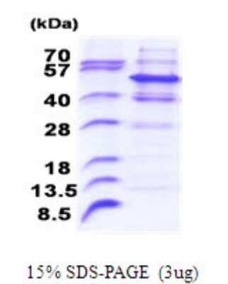 Recombinant Human Pellino 2 His Protein NBP2 51804 Bio Techne