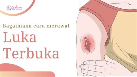 Bagaimana Cara Merawat Luka Terbuka Salam Homecare