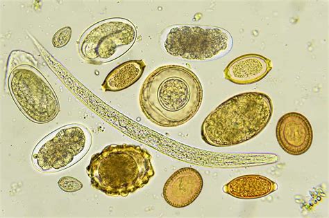 Techions Microscope In The Cloud For Parasites Nanalyze