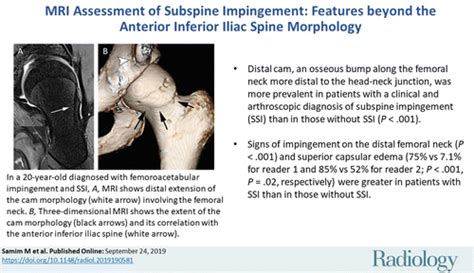 Mri Assessment Of Subspine Impingement Features Beyond The Anterior