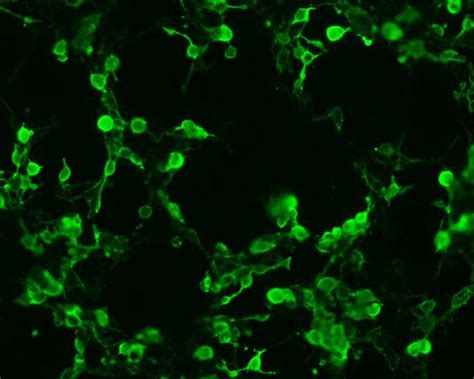 Human CD40 Ligand TNFSF5 CDNA Clones HG10239 Sino Biological