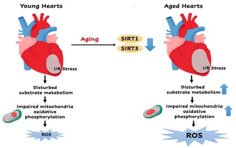 Antioxidants Free Full Text Sirt1 Sirt3 Modulates Redox Homeostasis During Ischemia