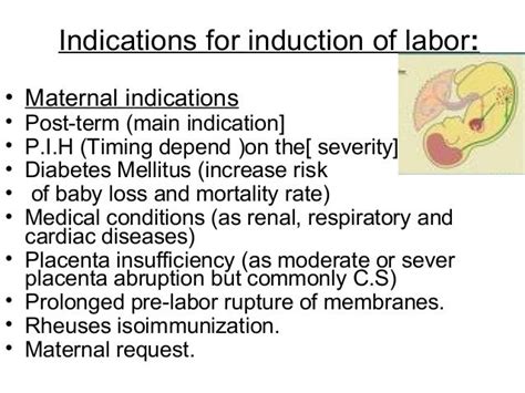 Induction Of Labor