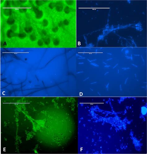 Morphological Representation Of Endophytic Fungi Isolated From Download Scientific Diagram