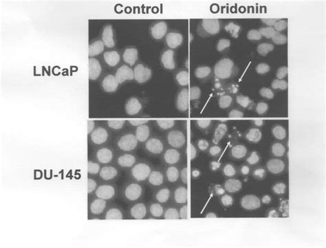 Induction Of Apoptosis In LNCaP And DU 145 Cells Following Treatment