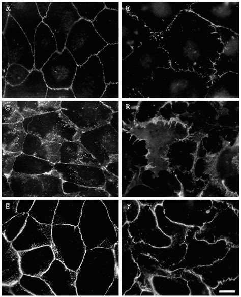 The Effect Of Pma On The Localization Of Junctional Proteins In Mdck