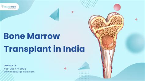 Bone Marrow Transplant In India Hospitals For Bone Marrow Transplant