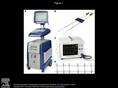 Irreversible Electroporation in Hepatopancreaticobiliary Tumours - ppt download