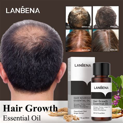 LANBENA Hair Growth Essential Oil | The best way to grow hair