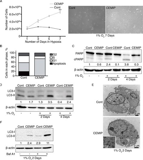 CEMIP Promotes Cell Survival In Hypoxic Conditions By Decreasing