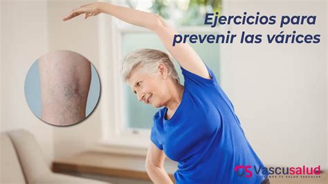 Ejercicios Para Prevenir Las Varices Vascusalud