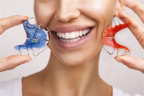 Expansor De Paladar Clinica Dental Sonrisa Segura