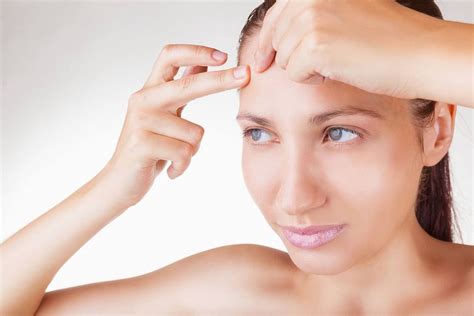 Farewell To Forehead Acne Causes Treatments And Prevention