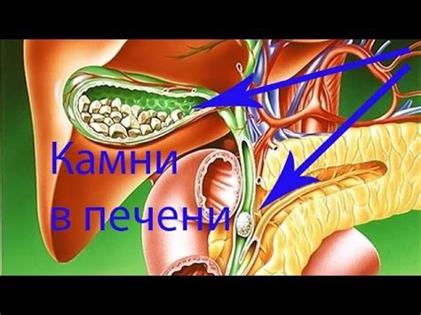 Чистка печени - YouTube