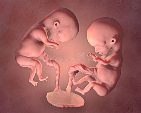 Monozygotic Twins In Uterus With Single Placenta D Illustration