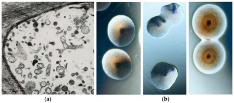 Plants Free Full Text Plants And Phytoplasmas When Bacteria Modify Plants