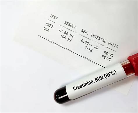 Rft Test Renal Function Test Importance Results Cost Health E