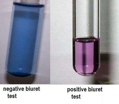 Biuret Test Principle Requirements Procedure And Result