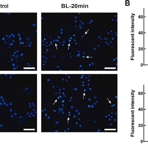 Morphology And Fluorescence Of Smmc And Hepg Cells After Bl