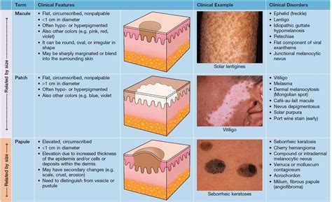 Medical Description Of Skin Lesions At Mark Lacroix Blog