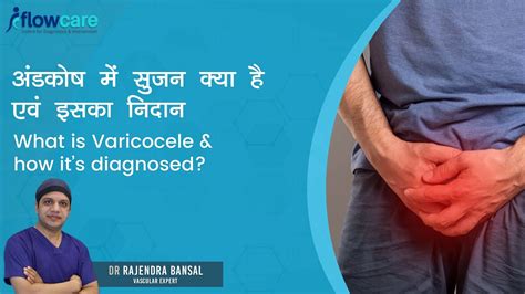 What Is Varicocele And How Its Diagnosed अंडकोष में सुजन क्या है एवं