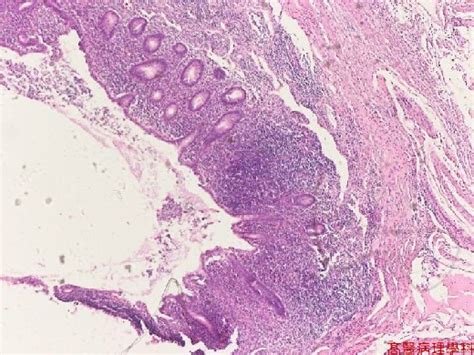 Appendix Histology