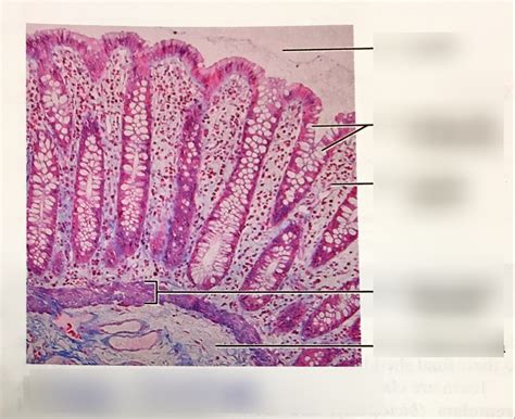 Large intestine histology Diagram | Quizlet