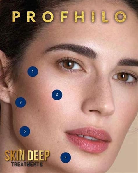 Profhilo Skin Deep Treatments Yorkshire