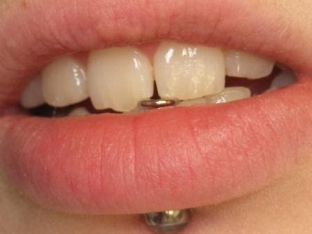 Oral health risks of tongue piercings | News | Dentagama