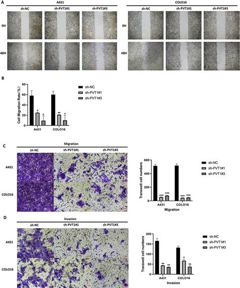 Lncrna Pvt Knockdown Inhibits Metastasis And Invasion Of A And