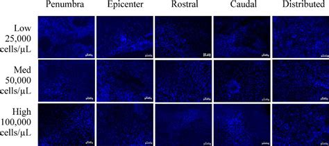 Effects Of Bone Marrowderived Msc Transplantation On Functional