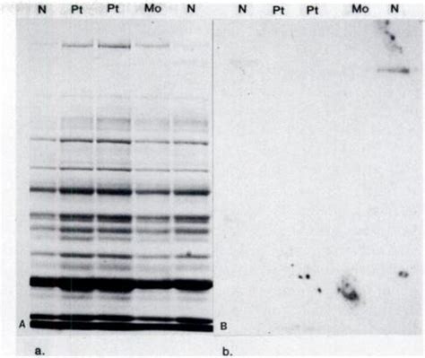 Immunoblotting And Autoradiography Of An Sds Page Gel Slab With Taii