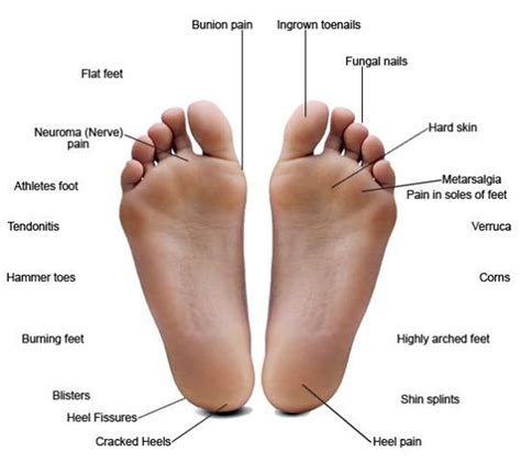 Diabetes and Foot Care: Foot Infections - Gluxus Health - COMFORTAID