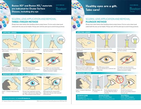 Scleral Contact Lenses Cla Contact Lens Technicians