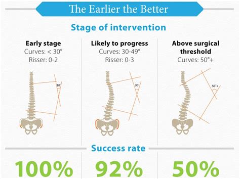 7 Types of Scoliosis & Their Differences | Treating Scoliosis