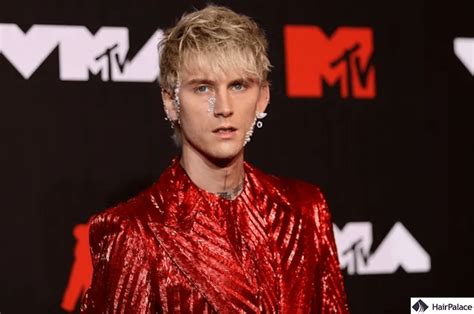 Machine Gun Kelly Hair Transplant Fut Or Fue