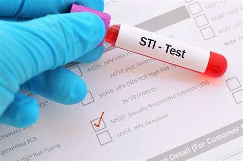 New Cdc Guidelines Endorse Opt Out Screening For 2 Most Common Stis Clinical Lab Products