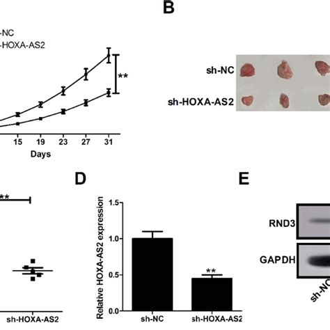 Depletion Of HOXA AS2 Slows Down Glioma Growth In Vivo The Male Nude