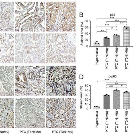 Expression Of Nf κb Components P65 P50 P P65 And P P50 In The Tissues Download Scientific