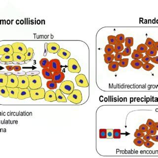 Three Theories Proposed For The Pathogenesis Of Collision Tumor