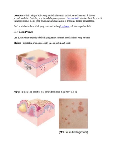 Lesi Kulit Adalah Jaringan Kulit Yang Tumbuh Abnormal Pdf