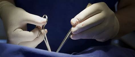 Anal Fistül Tedavisi Op Dr Mustafa Coşkun Obezite Cerrahisi