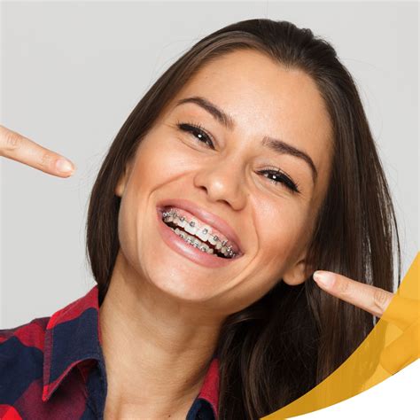 The Different Types Of Braces Which Option Is Right For You Smile