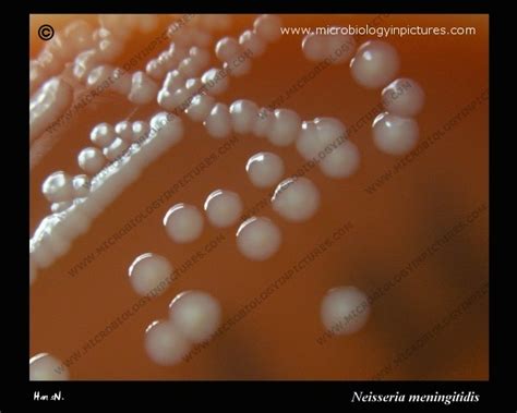 Picture of Neisseria meningitidis colonies. Growth characteristics on ...