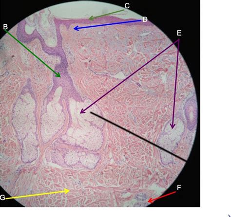 Solved a) Looking at the entire photomicrograph, what is the | Chegg.com 