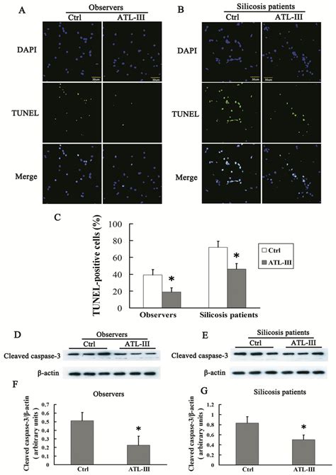 Atl Iii Reduced The Apoptosis Of Ams In Silicosis Patients A B