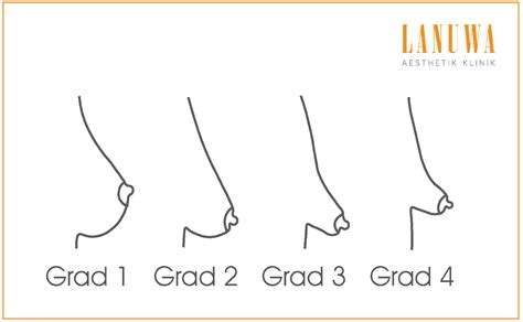 verschiedenen Formen der weiblichen Brust Lanuwa Ästhetik